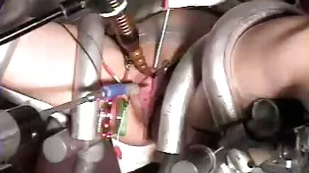 Cô Latin băng-nửa - Latin Nối tai phim set co trang